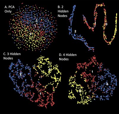 Semi-supervised learning of the electronic health record for phenotype stratification