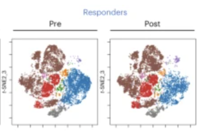 A phase I Ib trial and biological correlate analysis of neoadjuvant SBRT with single-dose durvalumab in HPV-unrelated locally advanced HNSCC