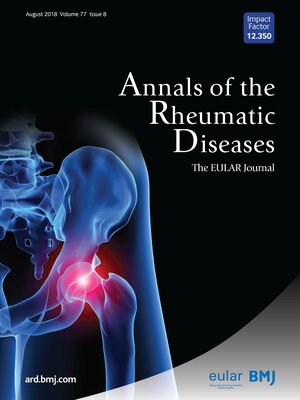 Metabolic pathways and immunometabolism in rare kidney diseases