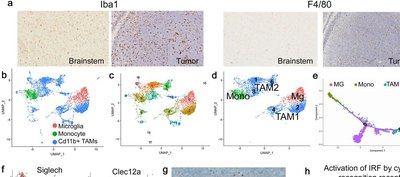 Single-cell transcriptomic profile reveals macrophage heterogeneity in medulloblastoma and their treatment-dependent recruitment